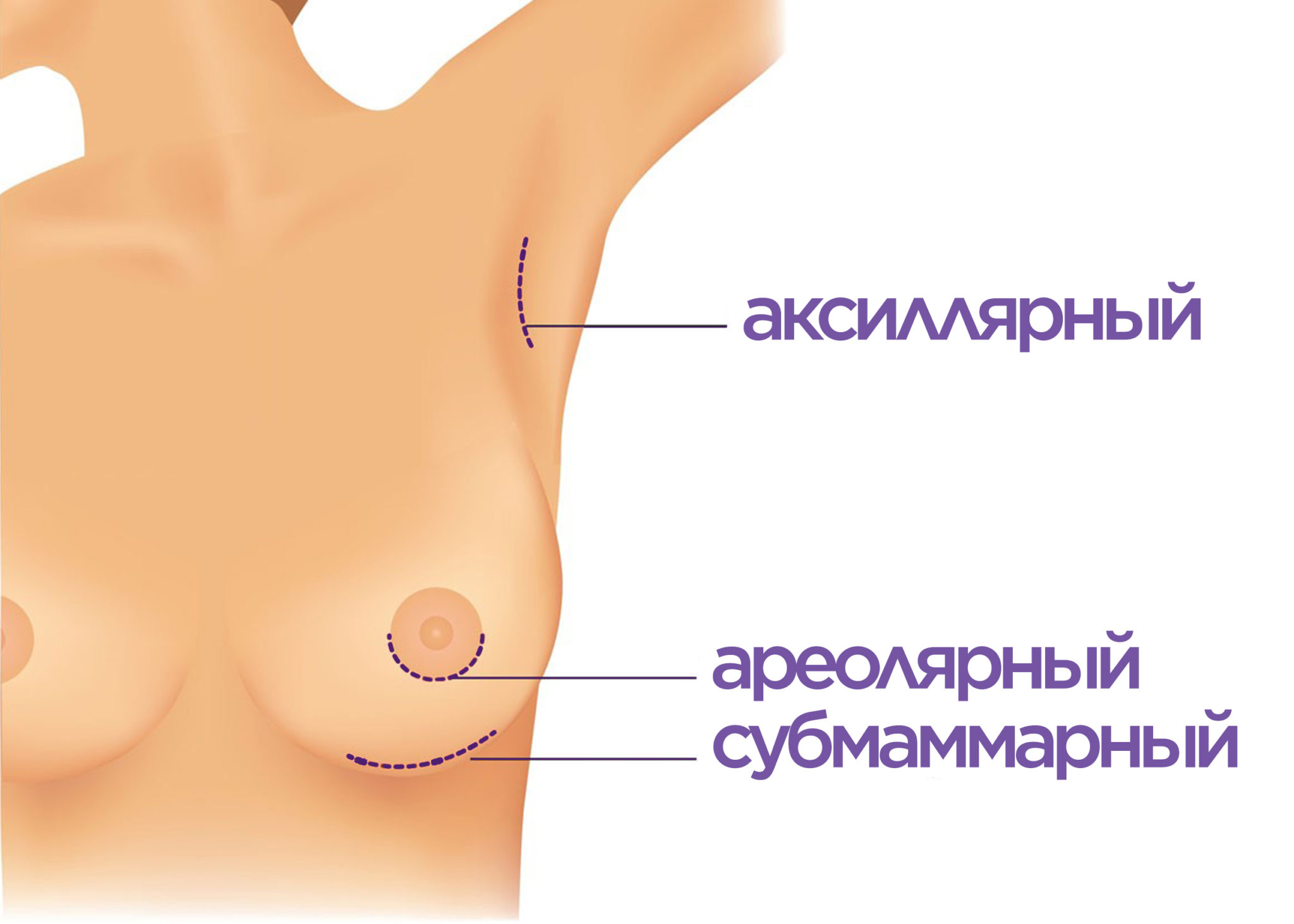 гормон отвечающий за рост груди у женщин фото 68
