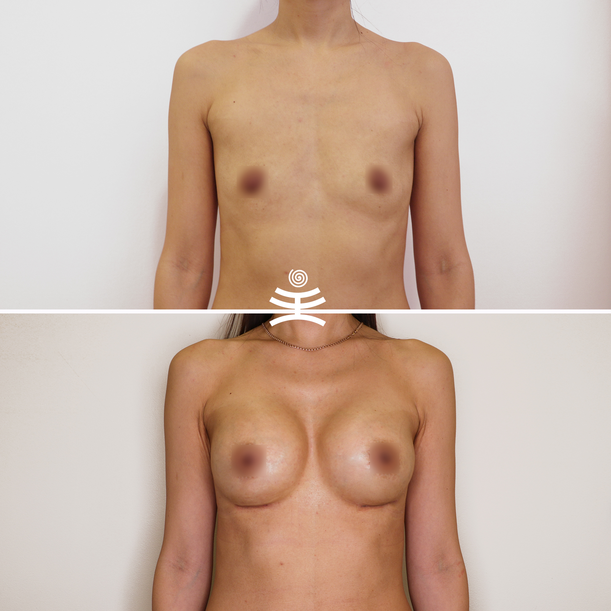 голая грудь после родов фото до и после фото 108